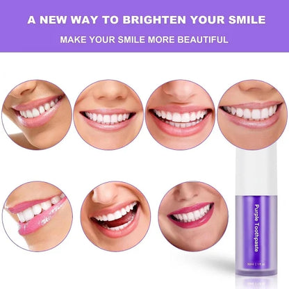 Teeth Brightening Hismiles V34